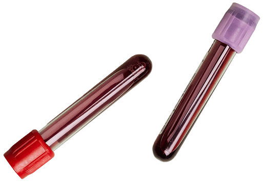 Two blood sample vials, one with a red cap and one with a purple cap, are lying on a white surface. Both tubes are filled with blood.