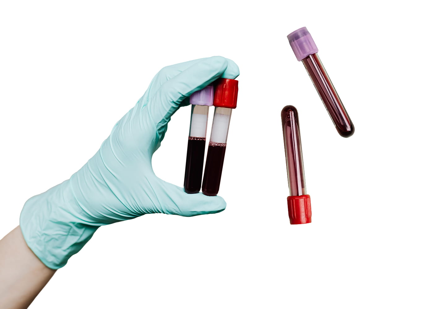 A gloved hand holds two blood-filled test tubes; two more blood-filled tubes are next to it, all against a white background.